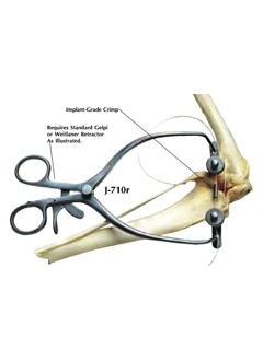 Tensioning Clamps