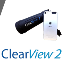 ClearView 2 Fundus Camera