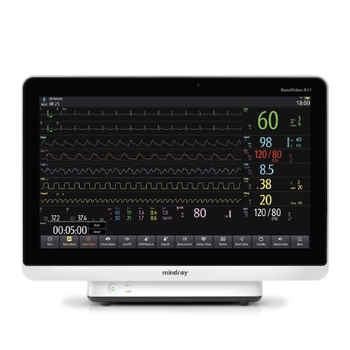 Mindray BeneVision N15 Monitor