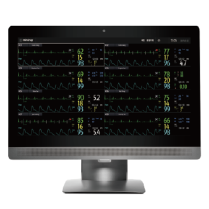 Benevision Central Monitoring System