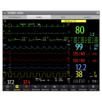 Benevision Central Monitoring System