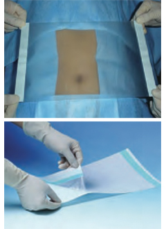 Clear Adhesive Surgical Drape (SDD-500, SDD-510 or SDD-520)